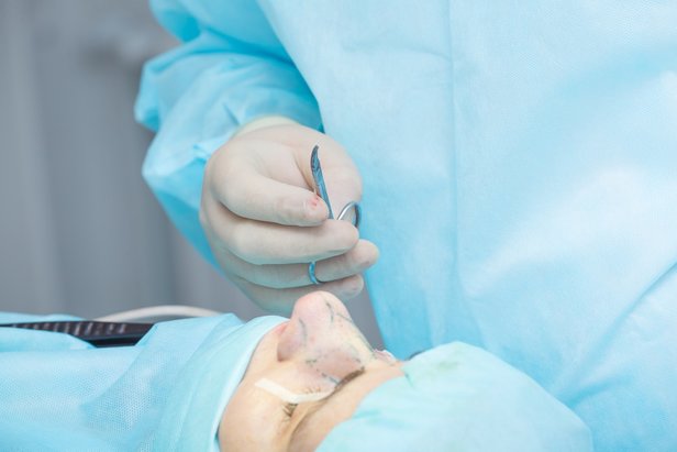 Rinoplastia o Cirugía de la Nariz - Dr. Díaz Infante - Medicina y Cirugía Estética Madrid