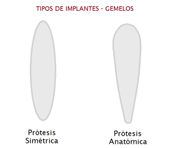 Tipos de Implantes de Gemelos | Dr. Díaz Infante - Madrid